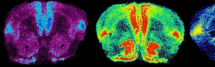 Brain scans