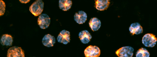 orange cells on a black background